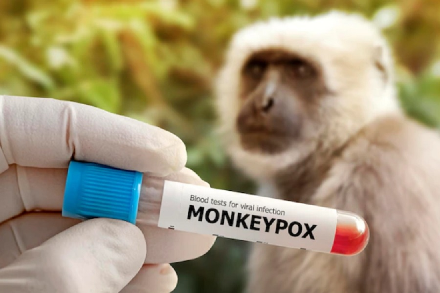 Mengenal Obat Cacar Monyet yang Sedang Dikembangkan